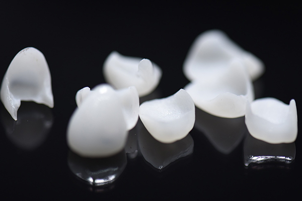 Composite material used in dentistry include alternatives to porcelain veneers